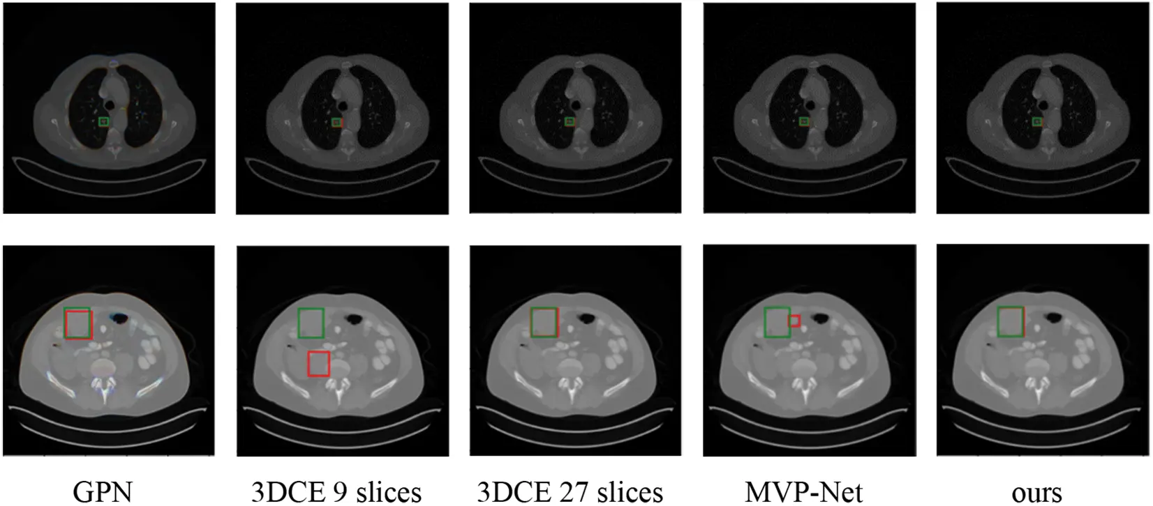 CMES | Free Full-Text | Enhanced Temporal Correlation for Universal ...