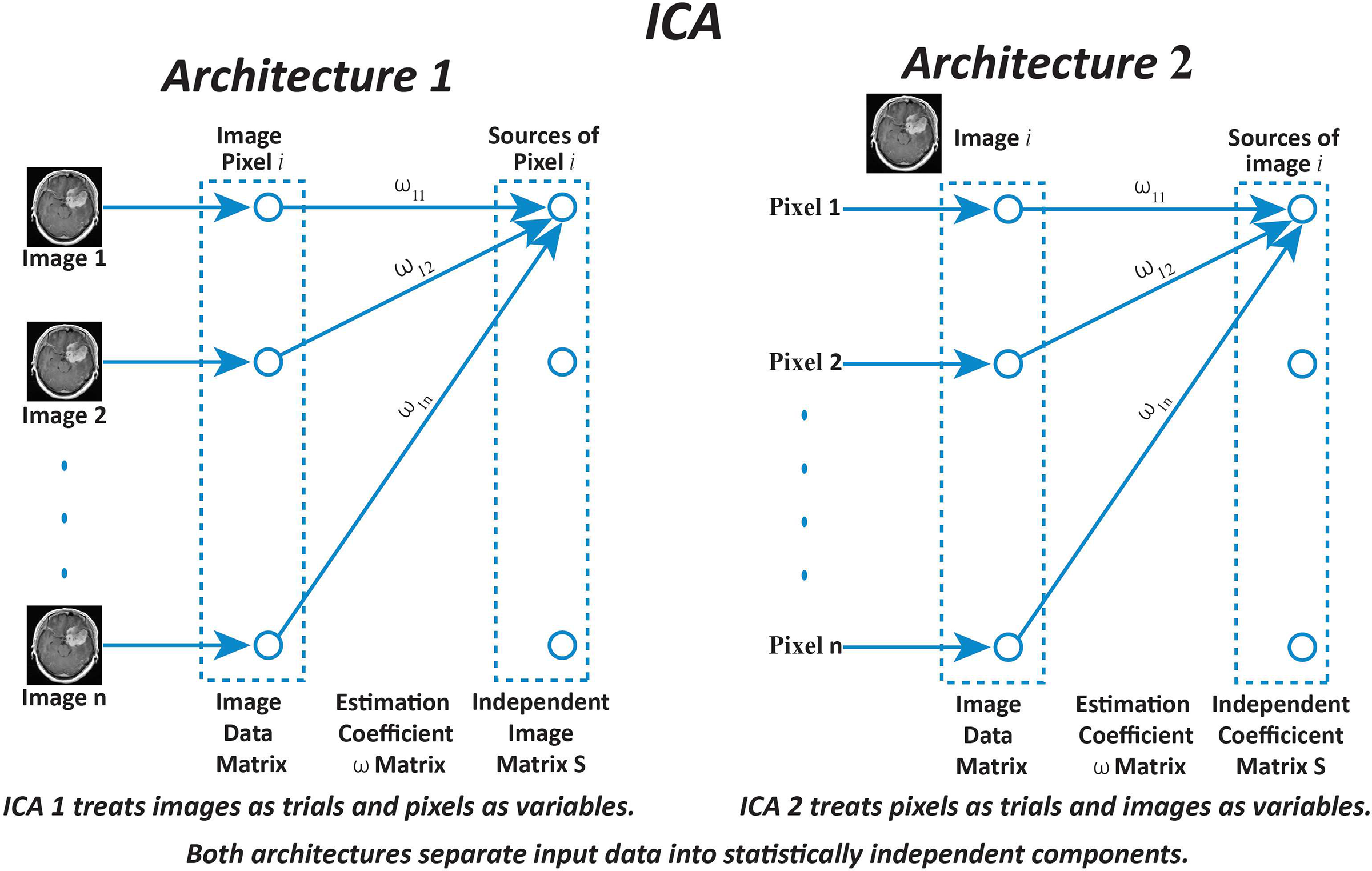 CMES | Free Full-Text | Advanced Computational Modeling for Brain Tumor ...