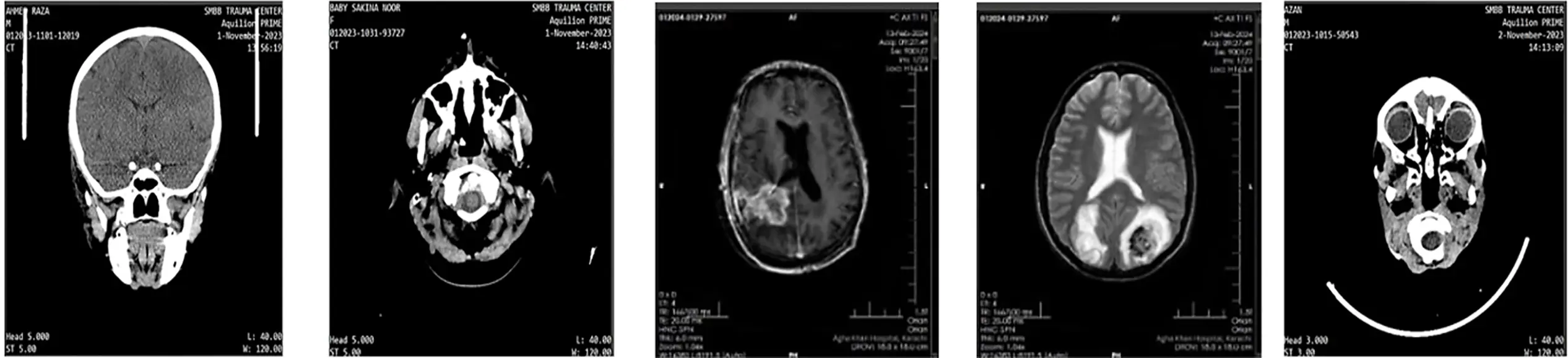 CMES | Free Full-Text | Automated Brain Tumor Classification from ...