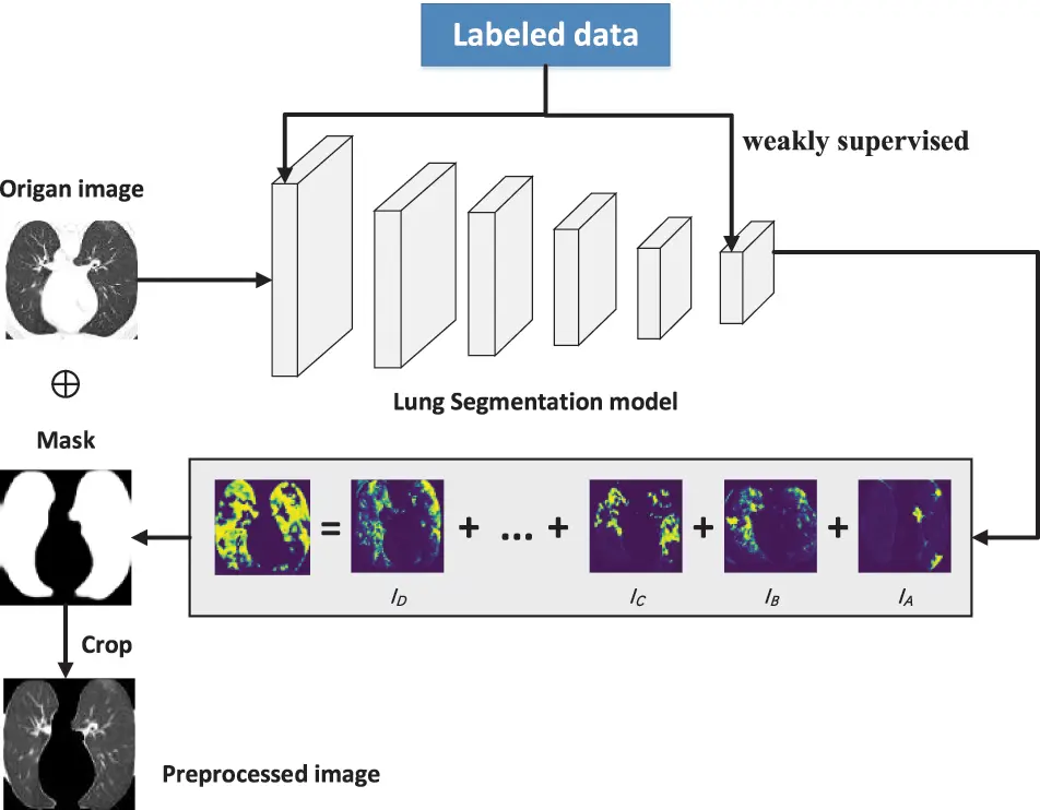 CMC | Free Full-Text | Deep Learning Models Based on Weakly Supervised ...
