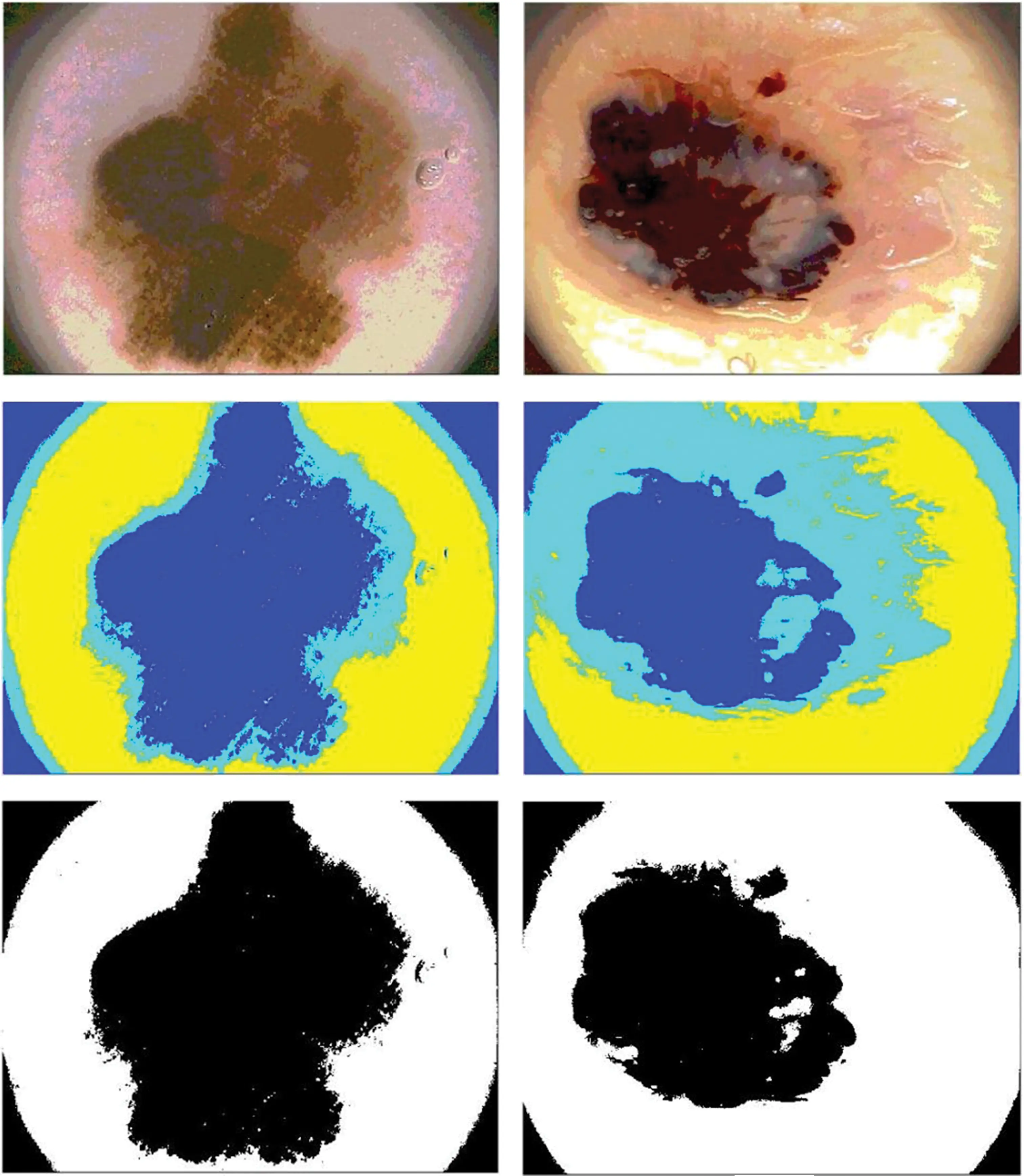 CMC | Free Full-Text | Multi-Class Skin Cancer Detection Using Fusion ...