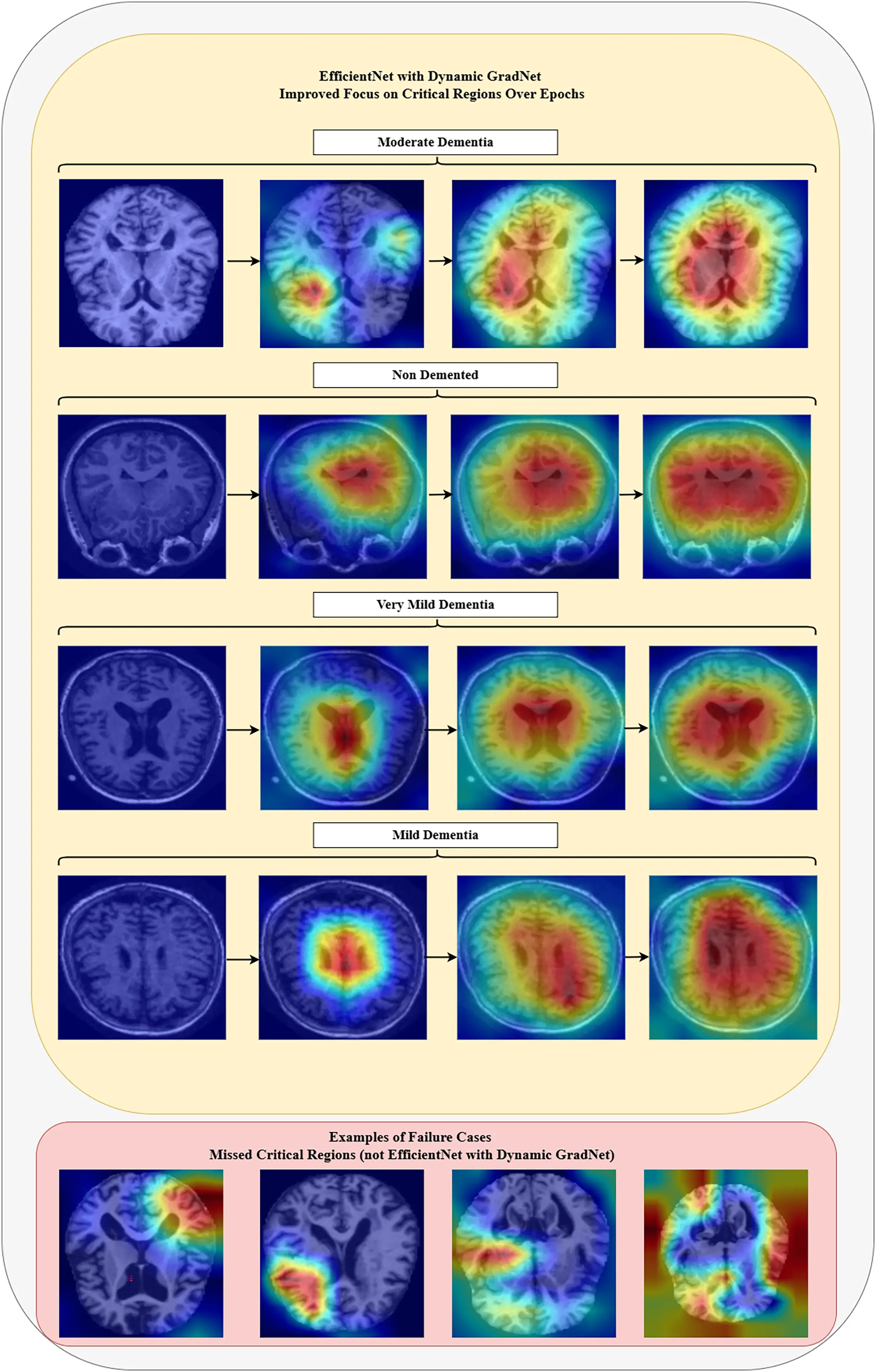 CMC | Free Full-Text | Dynamic Spatial Focus in Alzheimer’s Disease ...