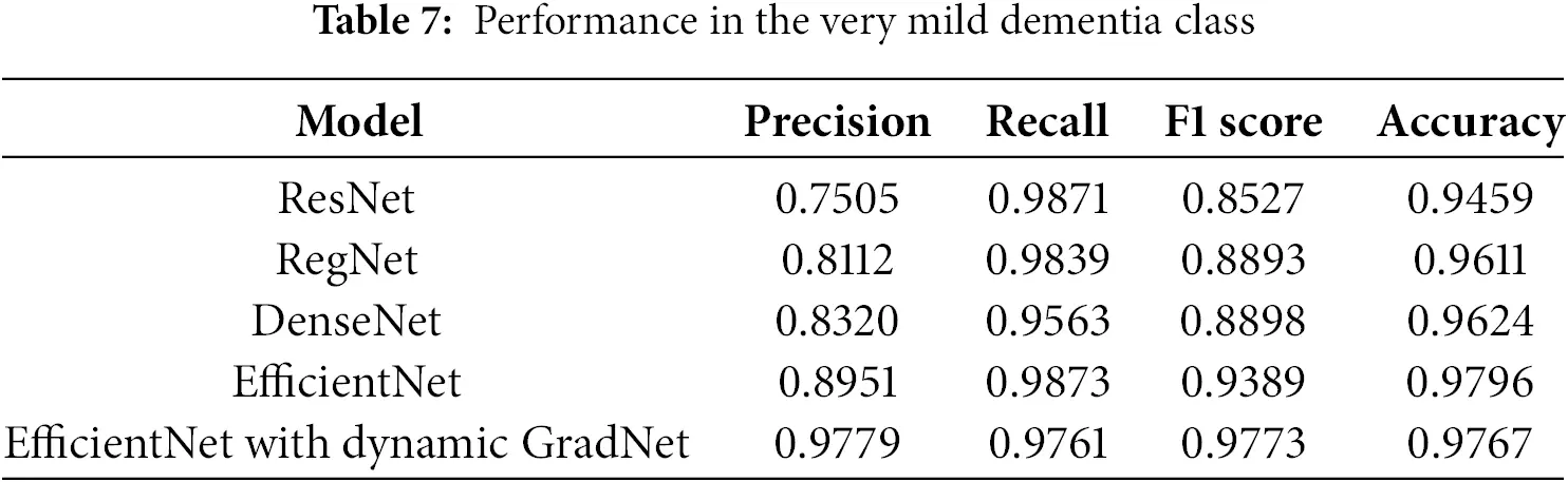 CMC | Free Full-Text | Dynamic Spatial Focus in Alzheimer’s Disease ...