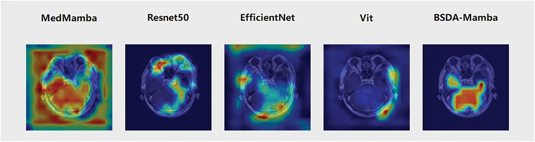 CMC | Free Full-Text | Enhancing Medical Image Classification with BSDA ...