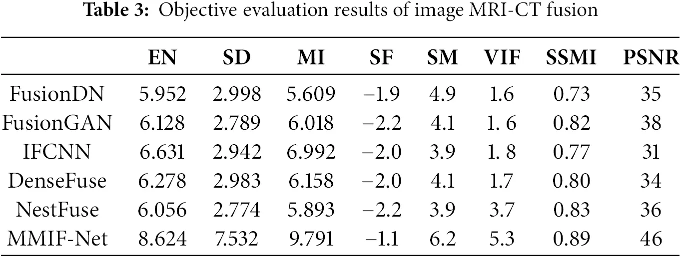 CMC | Free Full-Text | MMIF: Multimodal Medical Image Fusion Network ...