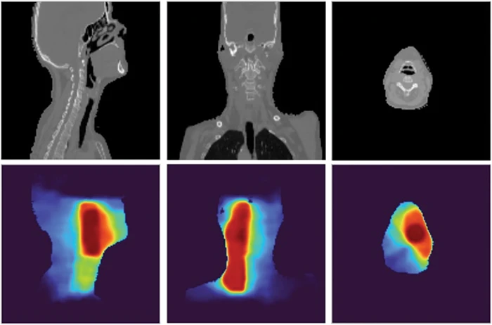 見逃し厳禁！おトクな IASC | Dose Radiotherapy 3D Predicting | Full-Text Free アイドル