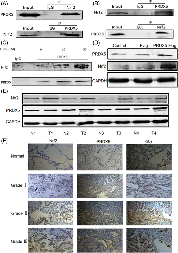 OR | Free Full-Text | The synergistic effects of PRDX5 and