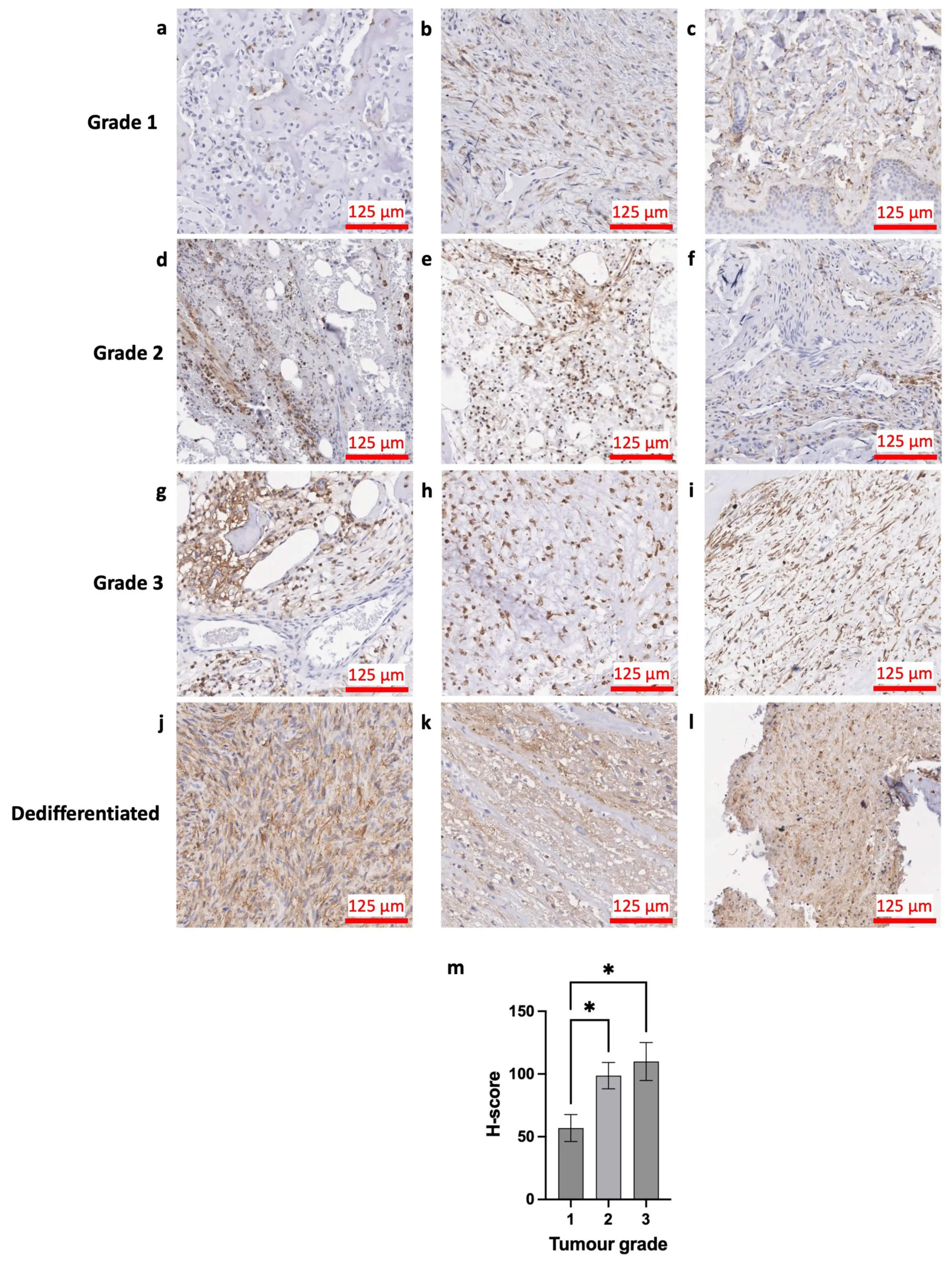 OR | Free Full-Text | Exploring the Role of CD44 in the Progression and ...