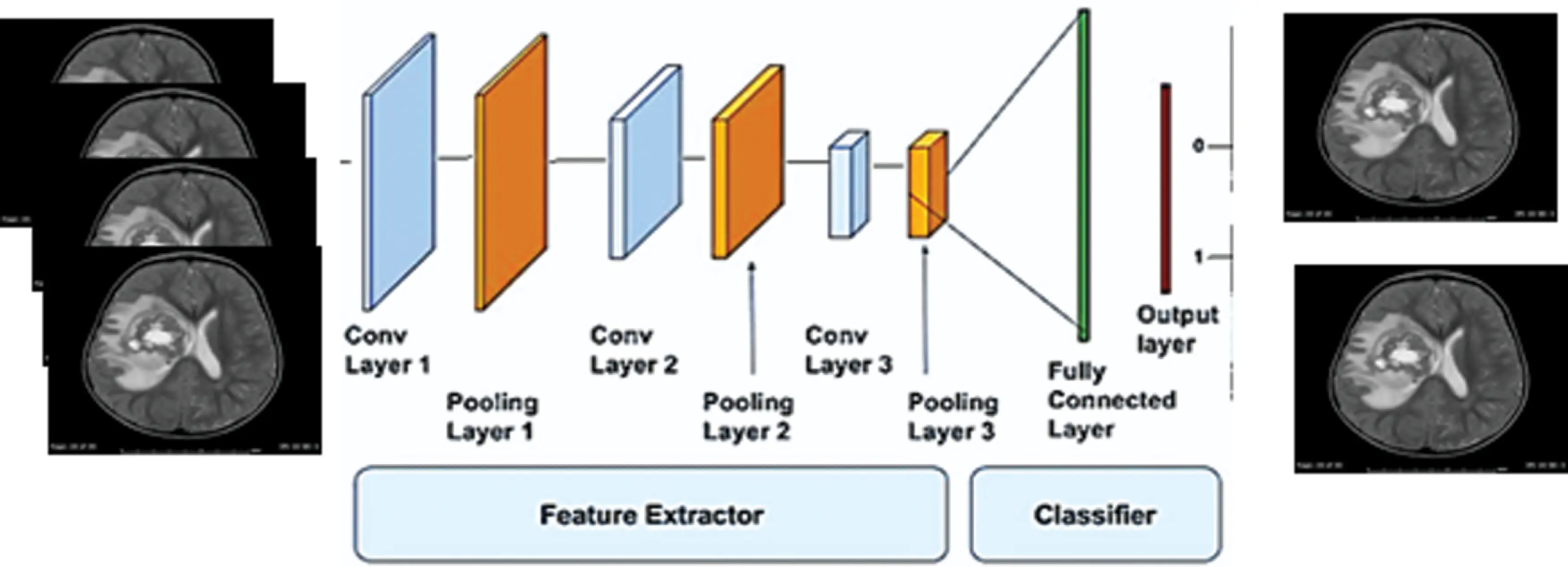 AGWO-CNN Classification for Computer-Assisted Diagnosis of Brain Tumors