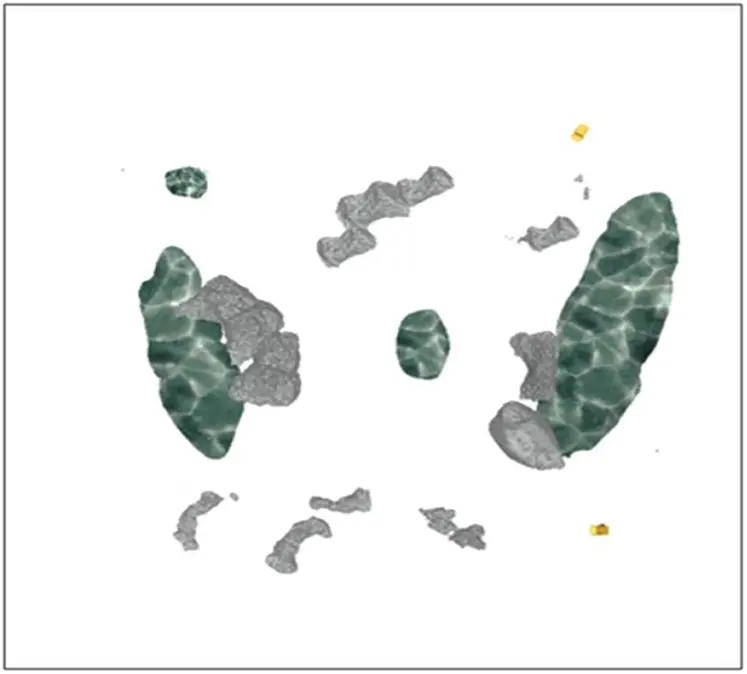 Path Planning Based on the Improved RRT* Algorithm for the Mining Truck