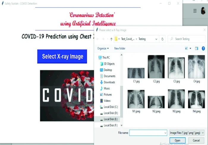 Prediction of Covid-19 Based on Chest X-Ray Images Using Deep ...