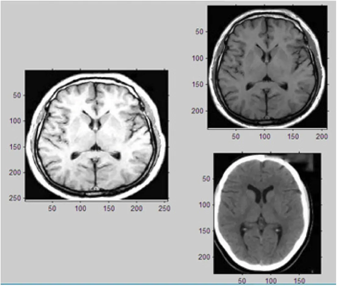 images