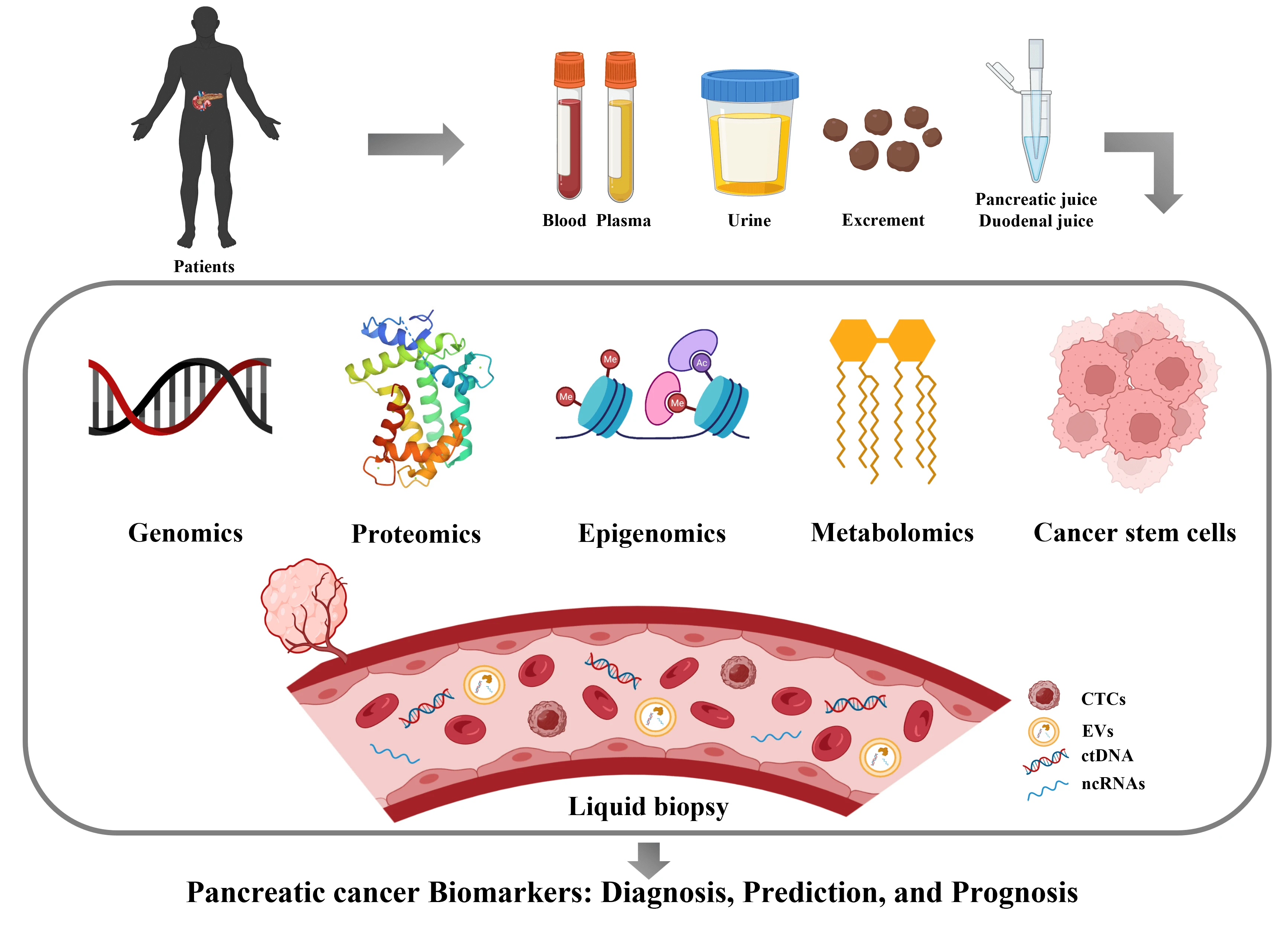Progress on diagnostic and prognostic markers of pancreatic cancer