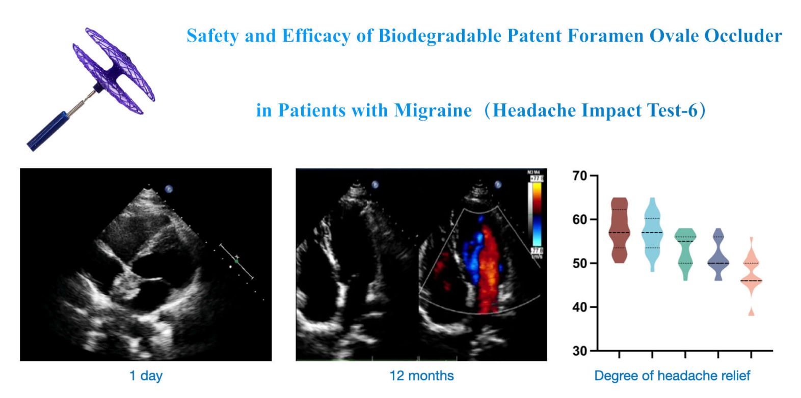 Safety and Efficacy of Biodegradable Patent Foramen Ovale Occluder in Patients with Migraine: A Clinical Trial