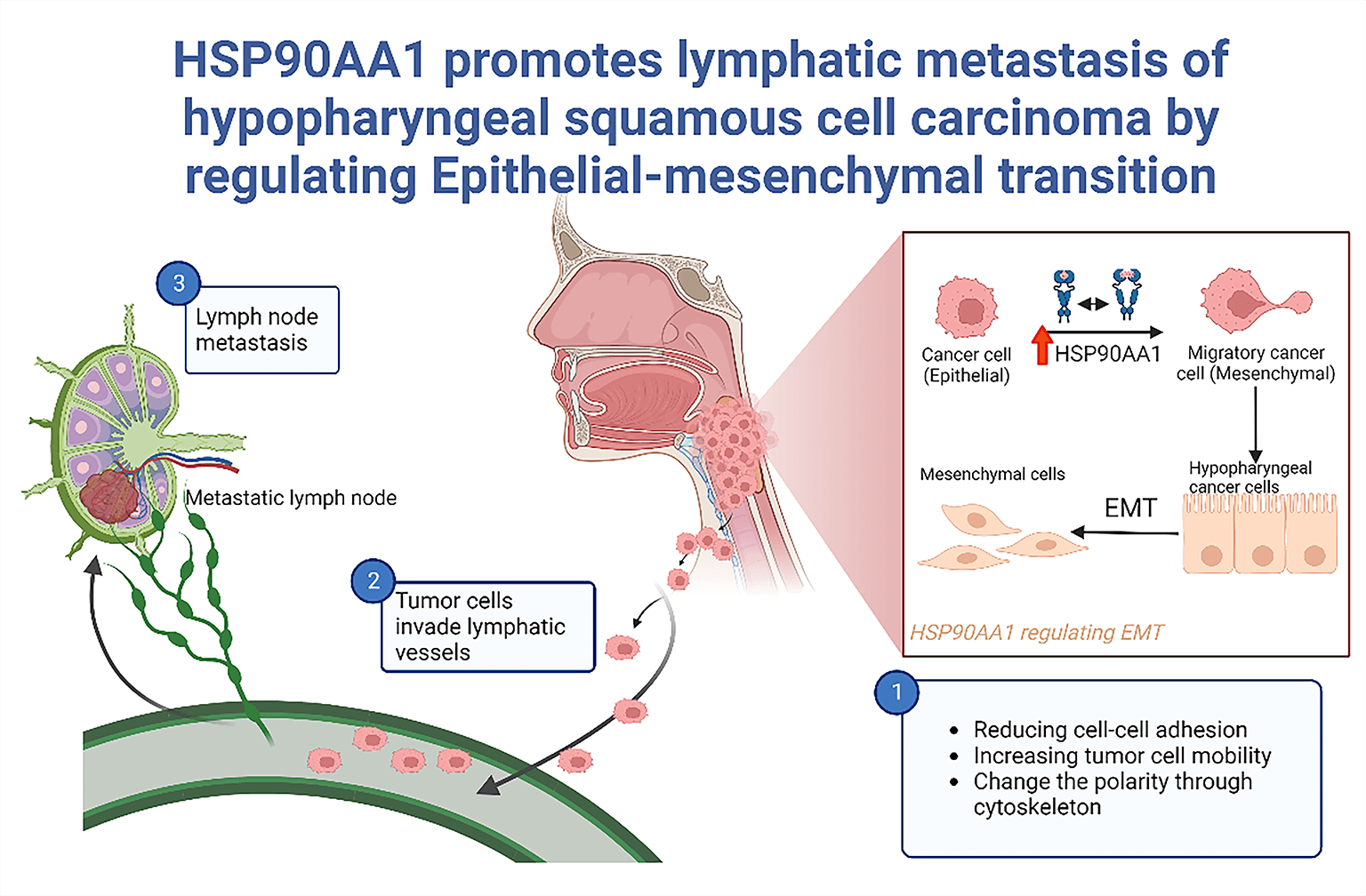 HSP90AA1 promotes lymphatic metastasis of hypopharyngeal squamous cell carcinoma by regulating epithelial-mesenchymal transition