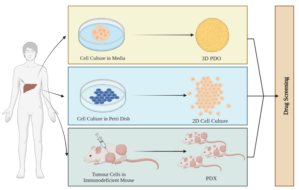 Mini-organs with big impact: Organoids in liver cancer studies