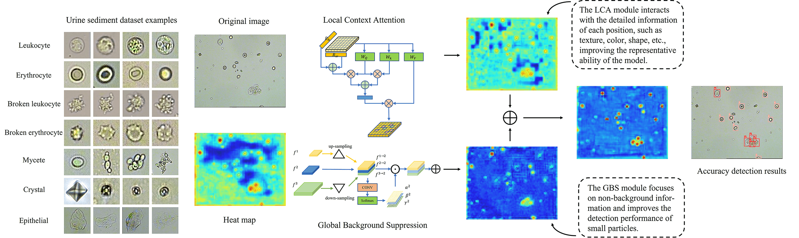 Learning Discriminatory Information for Object Detection on Urine Sediment Image