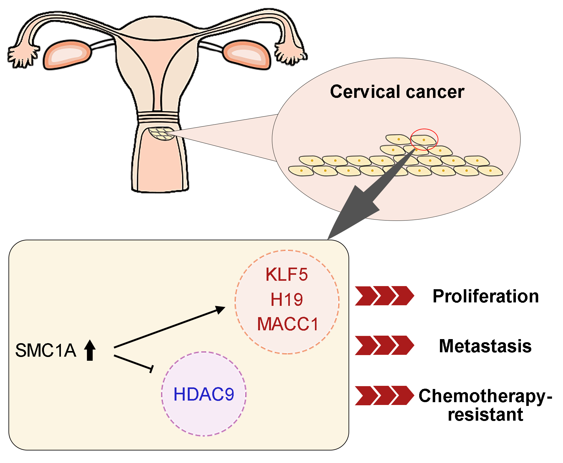 SMC1A served as a potential therapeutic target to regulate malignant phenotypes of cervical cancer