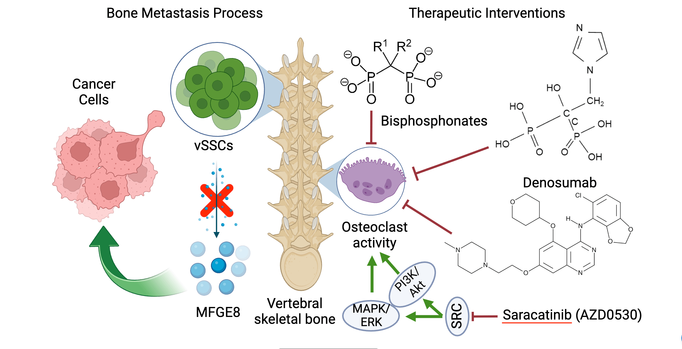 Game-changing insights on vertebral skeletal stem cells in bone metastasis and therapeutic horizons