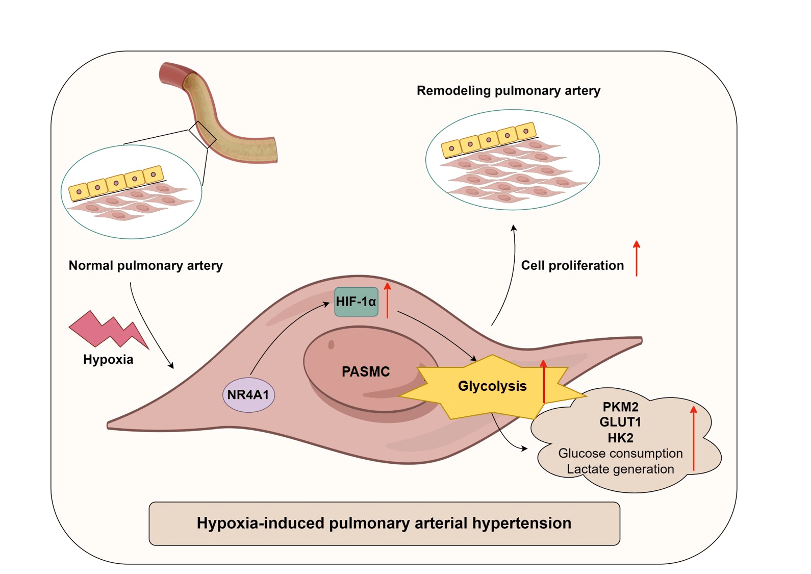 NR4A1 enhances glycolysis in hypoxia-exposed pulmonary artery smooth muscle cells by upregulating HIF-1α expression