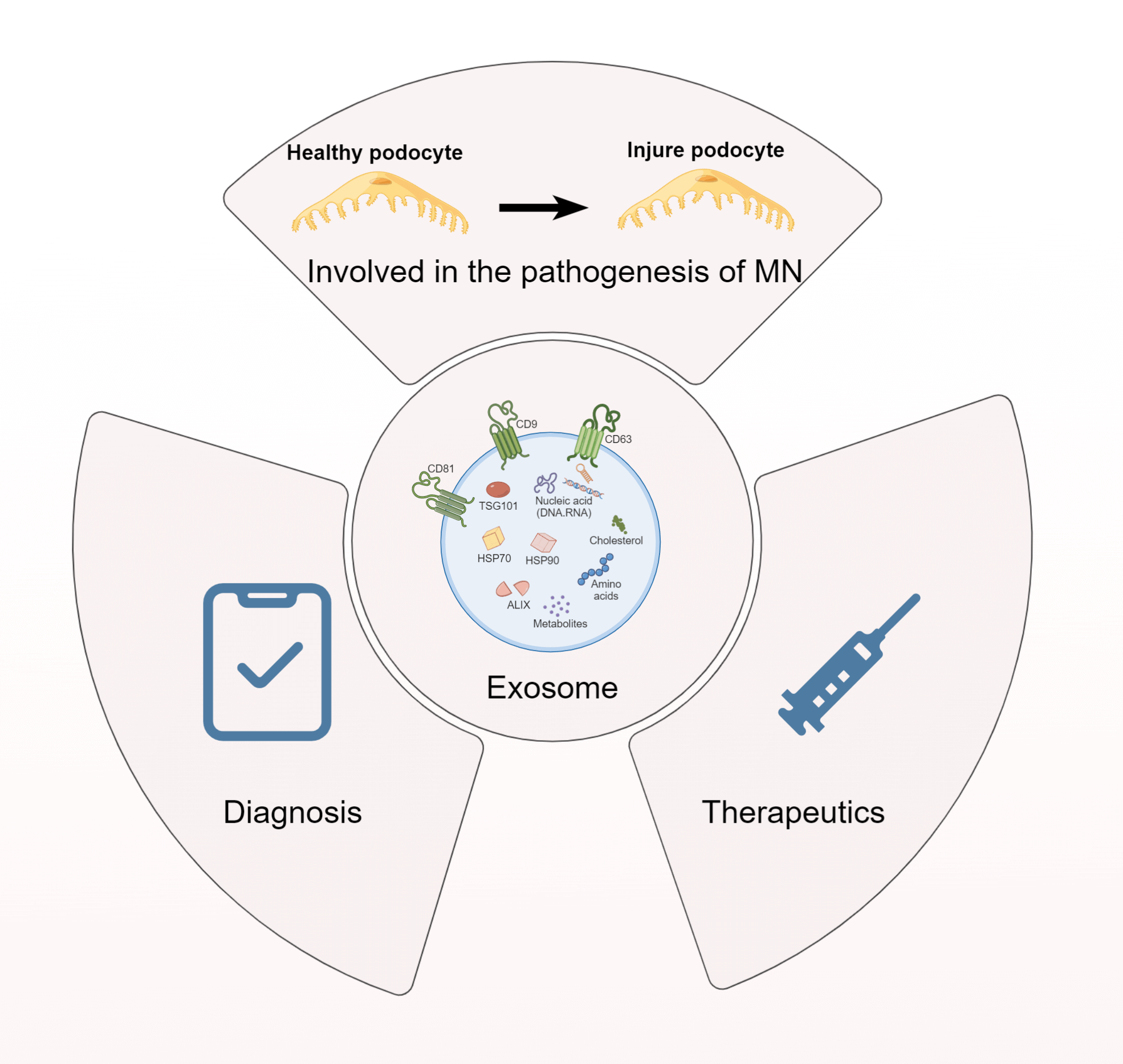 New insight into the role of exosomes in idiopathic membrane nephropathy