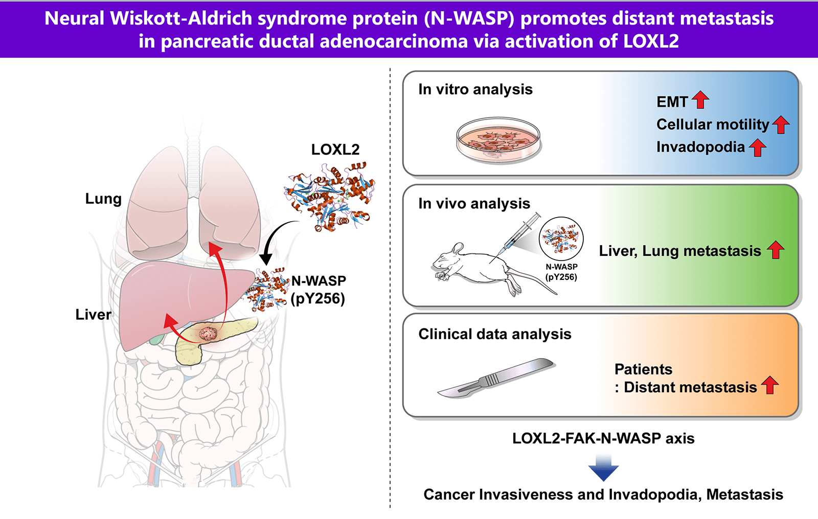Neural Wiskott-Aldrich syndrome protein (N-WASP) promotes distant metastasis in pancreatic ductal adenocarcinoma via activation of LOXL2