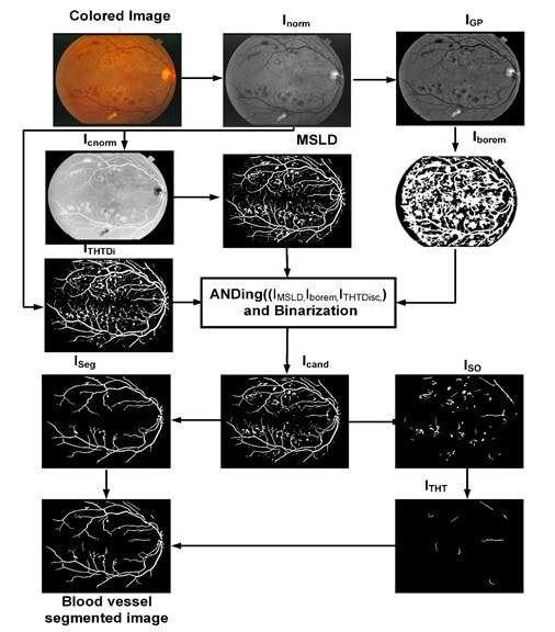 An Implementation of Multiscale Line Detection and Mathematical Morphology for Efficient and Precise Blood Vessel Segmentation in Fundus Images
