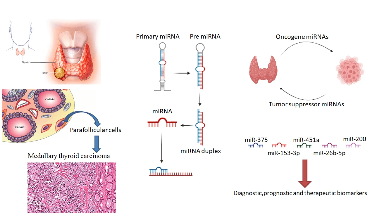 MicroRNAs in thyroid cancer with focus on medullary thyroid carcinoma: potential therapeutic targets and diagnostic/prognostic markers and web based tools