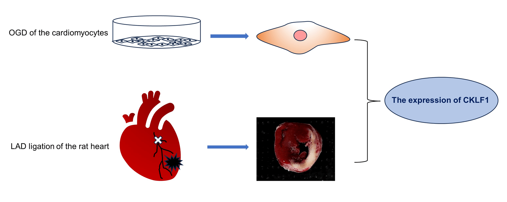 Chemokine-like factor 1 (CKLF1) is expressed in myocardial ischemia injury <i>in vivo</i> and <i>in vitro</i>