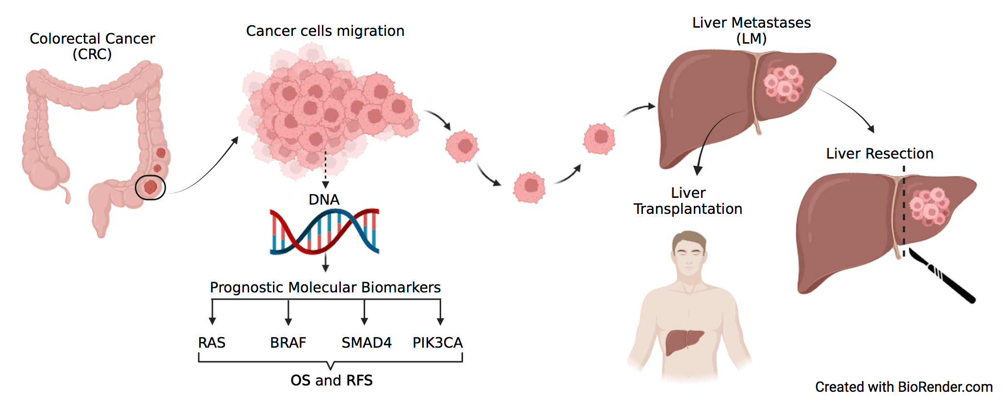 The challenge of molecular selection in liver-limited metastatic colorectal cancer for surgical resection: a systematic review and  meta-analysis in the context of current and future approaches