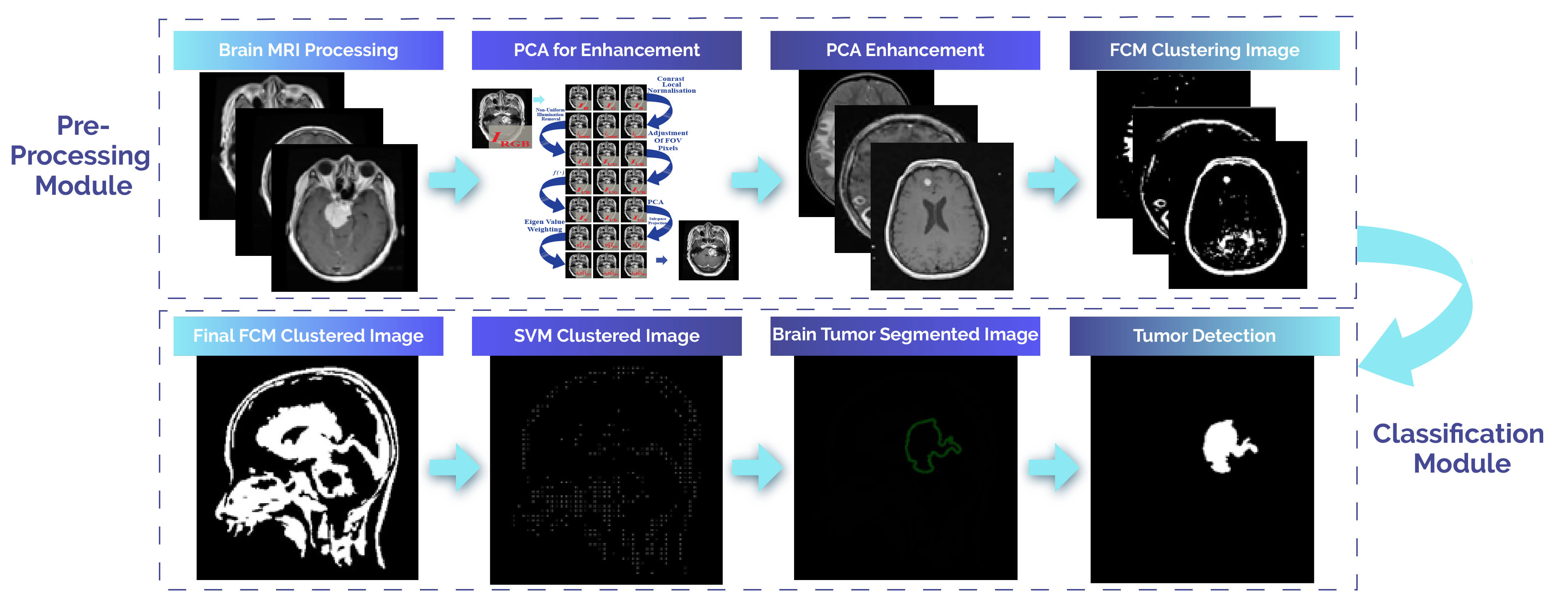 Contrast Normalization Strategies in Brain Tumor Imaging: From Preprocessing to Classification
