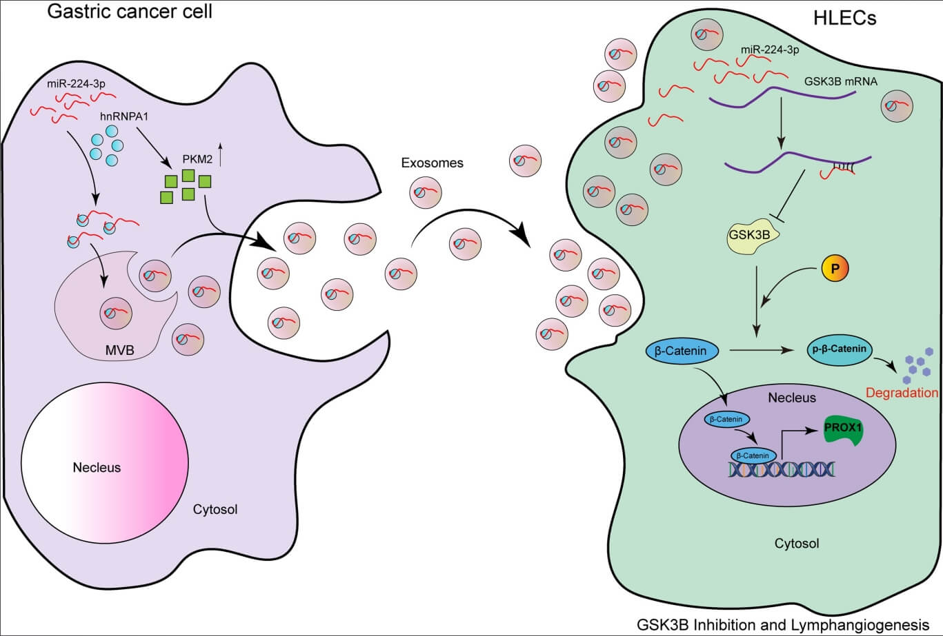 Exosomal miR-224-3p promotes lymphangiogenesis and lymph node metastasis by targeting GSK3B in gastric cancer