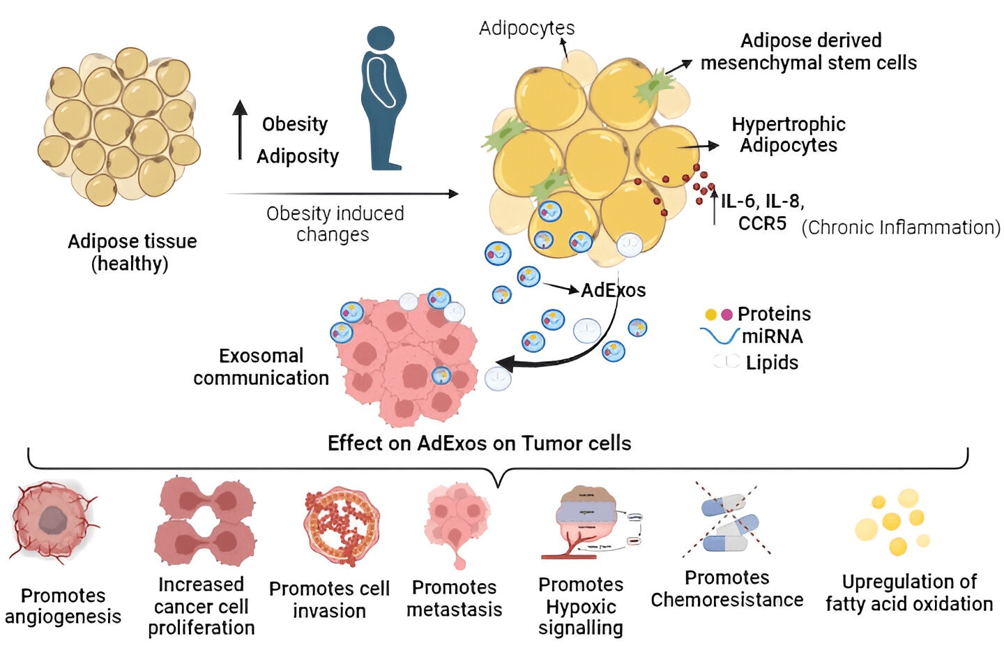 Research progress on the role of adipocyte exosomes in cancer progression