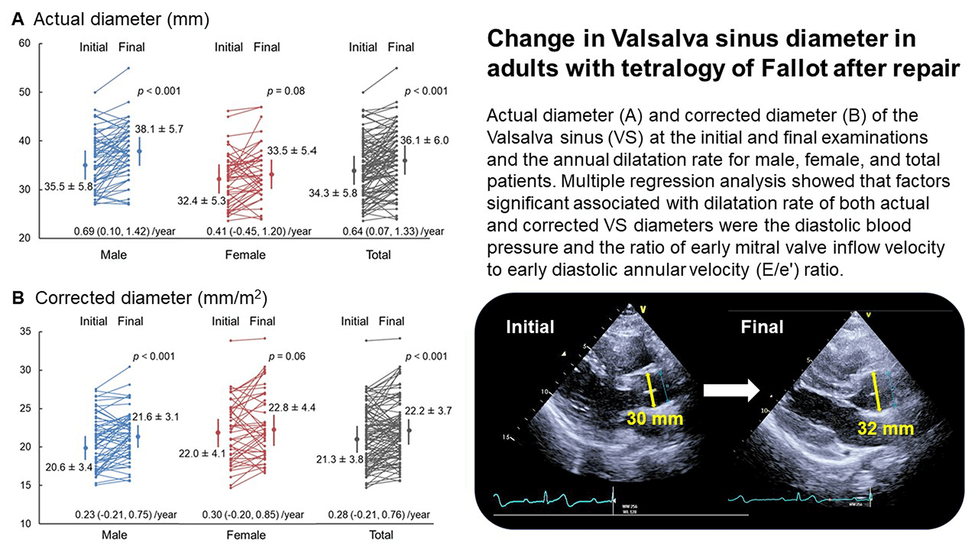 Prospective Cohort Research of Aortic Root Dilatation after Surgical Repair in Adults with Tetralogy of Fallot (TRANSIT)